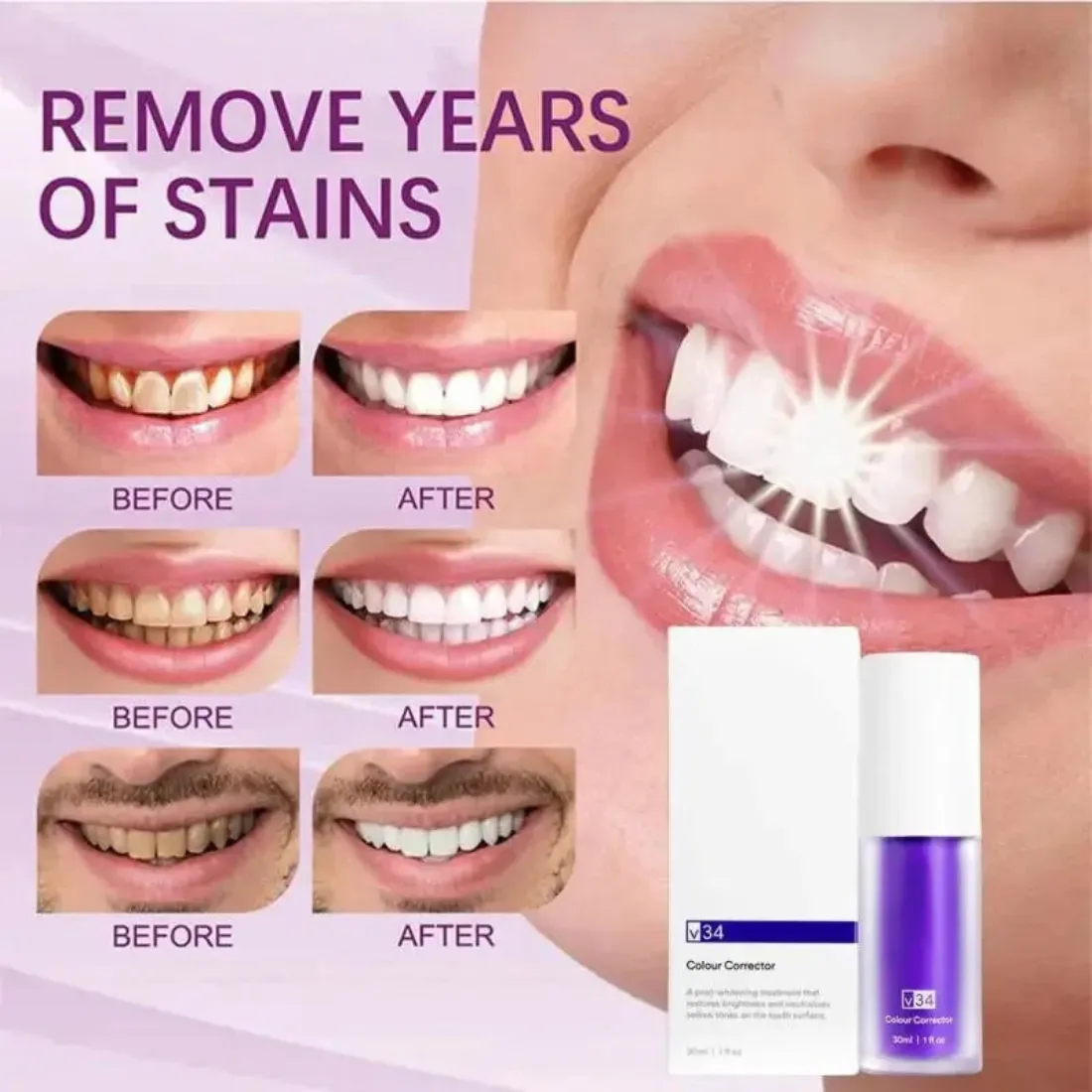 Whitening Toothpaste